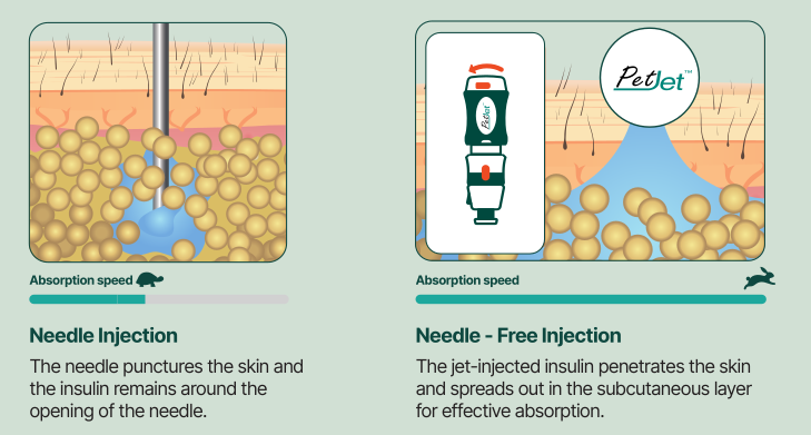 Benefits of Needless injection
